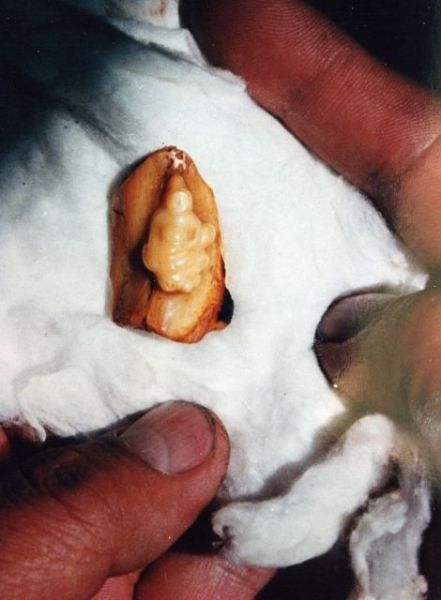 Crémation GK XVI - 07_Cremation